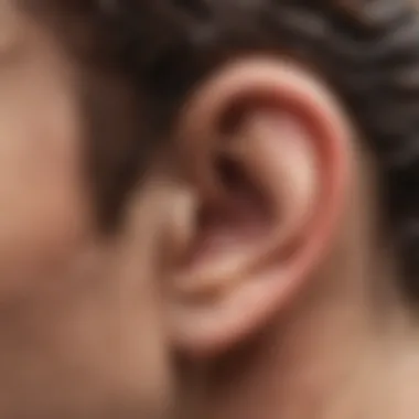Understanding Swimmer's Ear and Its Implications Illustration of a swimmer's ear